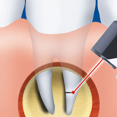 Oralchirurgie